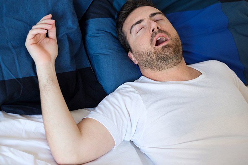 Soft Palate Ablation for Snoring in New Canaan